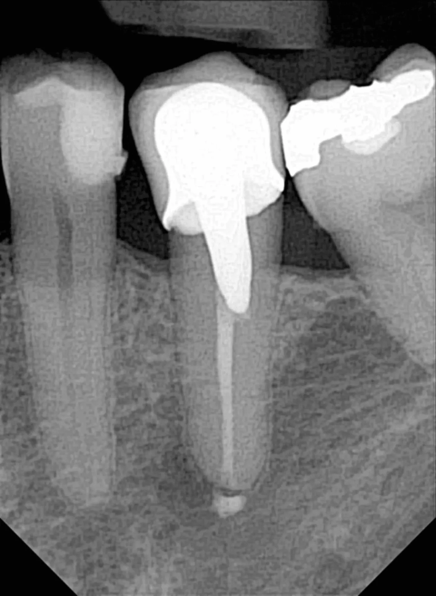 Owandy Opteo capteur intra-oral imagerie