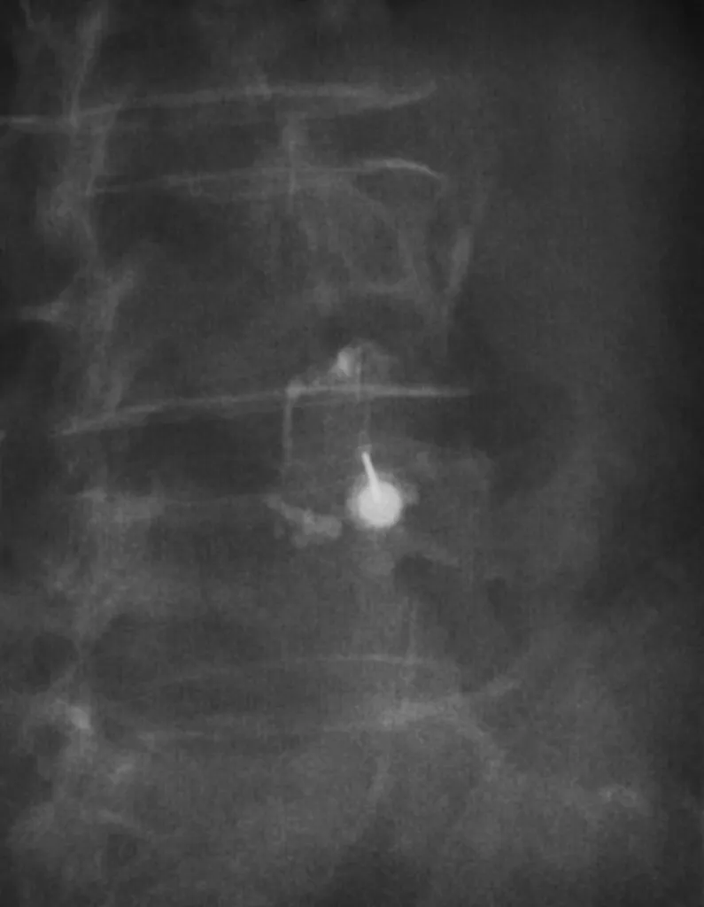 Notre zone d'activité pour ce serviceCentre de radiographie pour passer une radio de l'épaule
