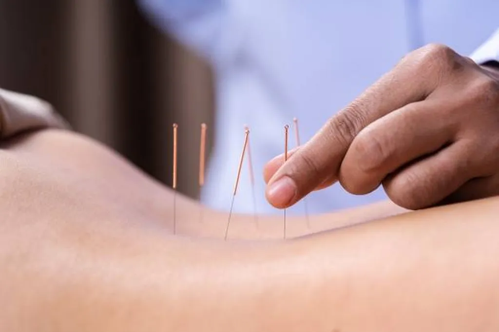 Soins palliatifs et accompagnement lors d'un cancer par l'acupuncture et l'énergétique à Lyon
