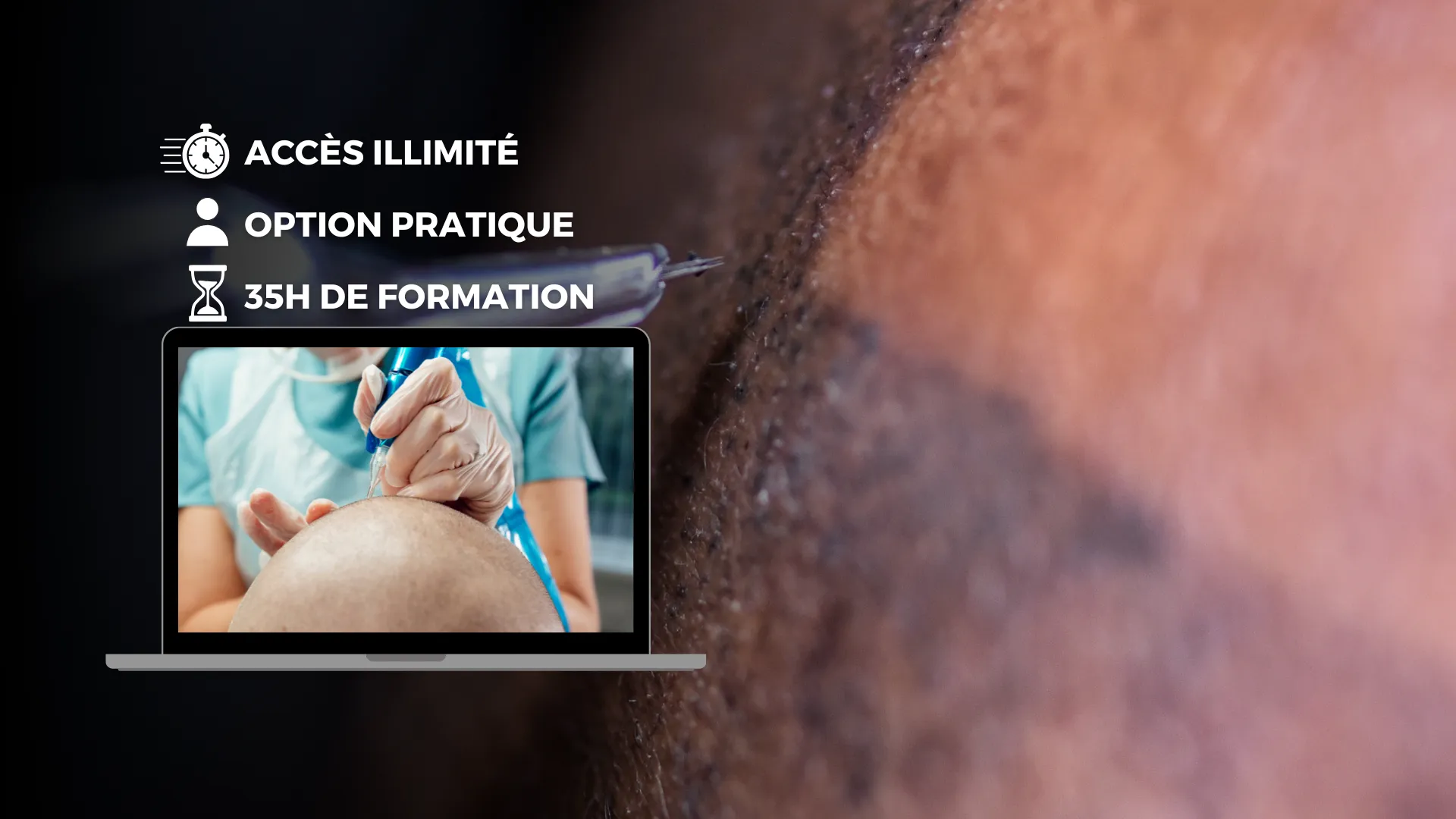 Formation tricopigmentation