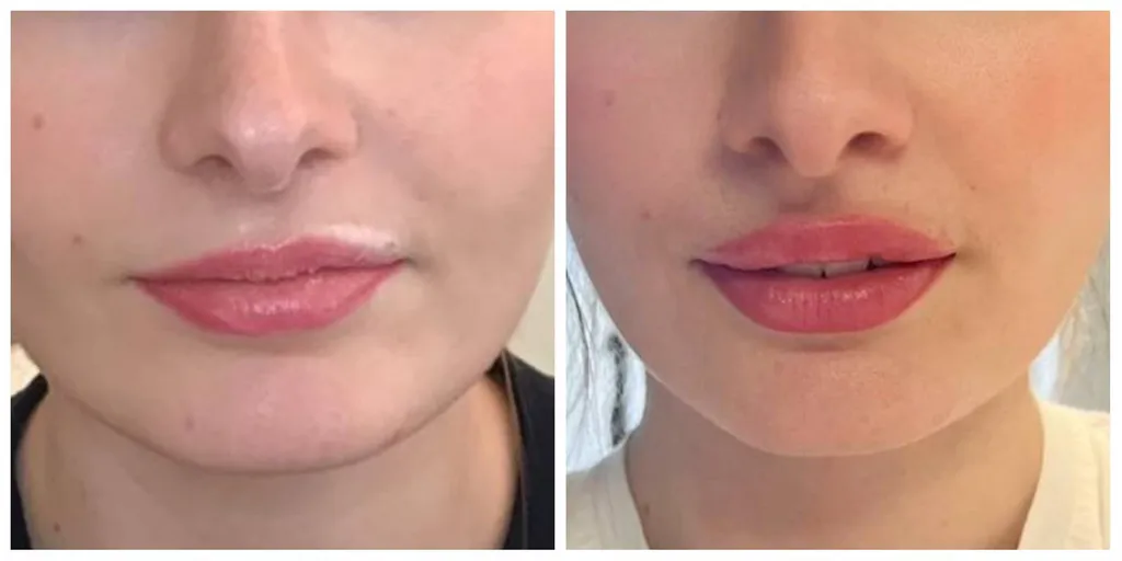 russian lip, levres, egolips